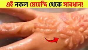 Beware of Fake Mehendi: A Hidden Danger for Your Skin